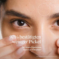 Anti Pickel Waschgel, 200 ml