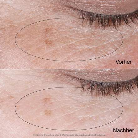 Oogcrème Gel Collageen Bank, 15 ml