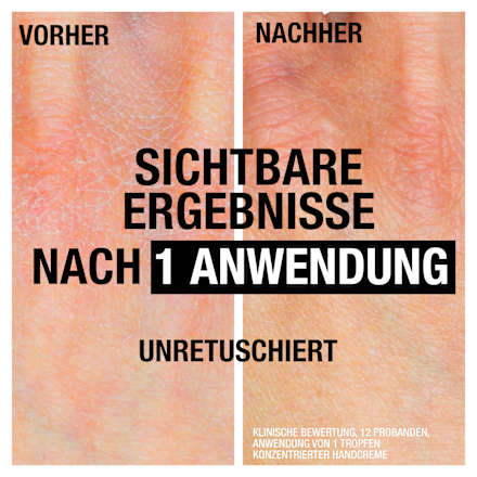 Hand- en nagelcrème, snel intrekkend, 75 ml