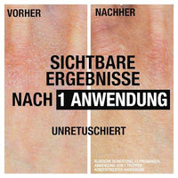 Handcrème Intense Herstellend, 50 ml