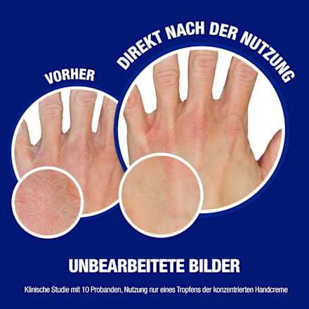Direct intrekkende handcrème, reisformaat, 15 ml