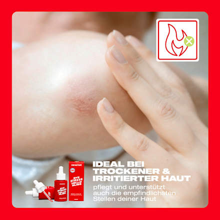 Lichaamsolie SOS Huidolie, 30 ml