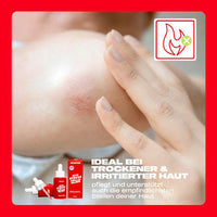 Lichaamsolie SOS Huidolie, 30 ml