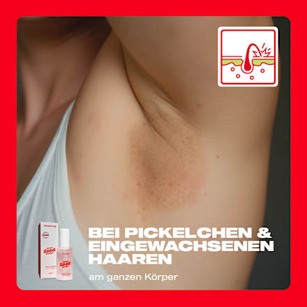 Peeling Spray Solution, 50 ml nevernot
