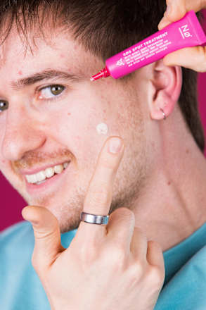 SØS Spot Treatment, 15 ml