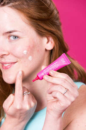 SØS Spot Treatment, 15 ml