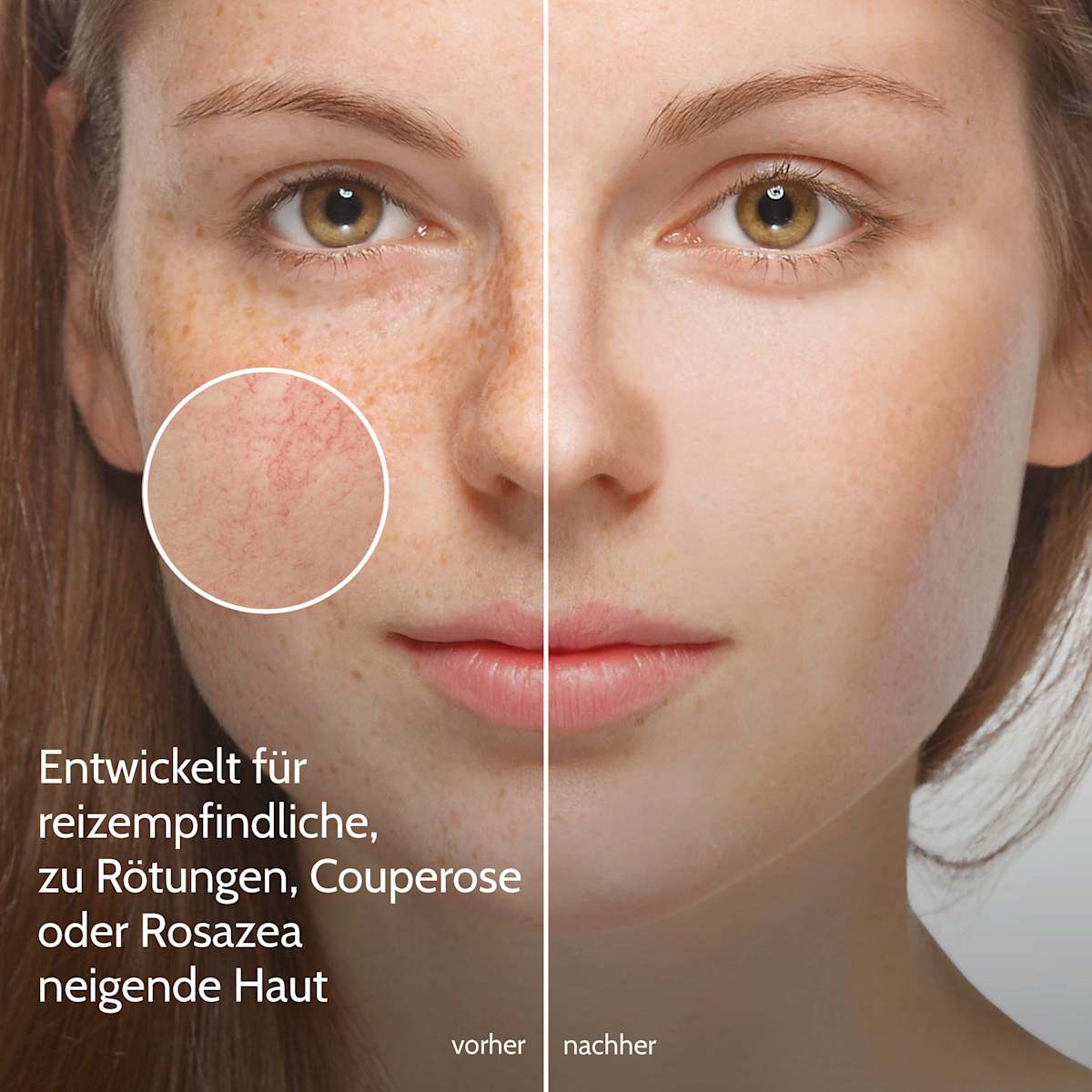 Salthouse Gesichtscreme Anti Rötungen, 30 ml