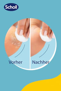 Ersatzrollen Hornhautentferner 2in1, 2 St Scholl
