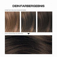 Ansatzset Root Fix 6 Hellbraun, 1 St