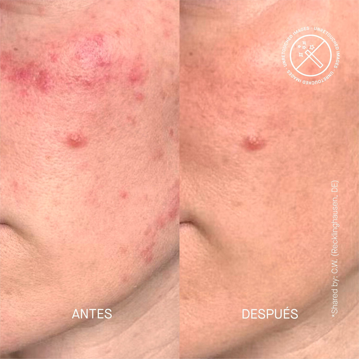 TERAMYDE Gesichtsserum Treatment Ceramide, 30 ml