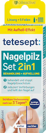 Nagel schimmel set 2 in 1, 1 stuk