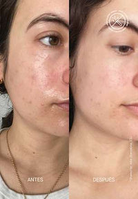 Gesichtscreme Barrier Restoring Hydrating, 50 ml