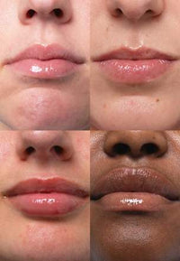Lipgloss Clear LSF 50, regenerierend, 15 ml