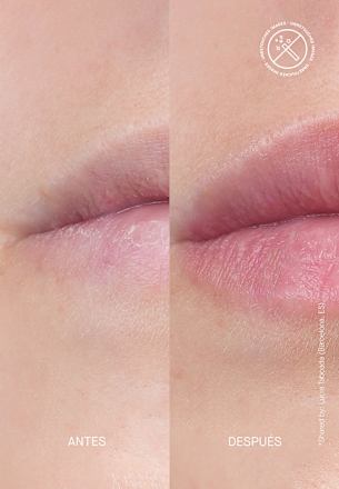 Lipverzorging Volume Hydraterende Behandeling, 15 ml