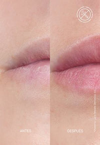 Lipverzorging Volume Hydraterende Behandeling, 15 ml